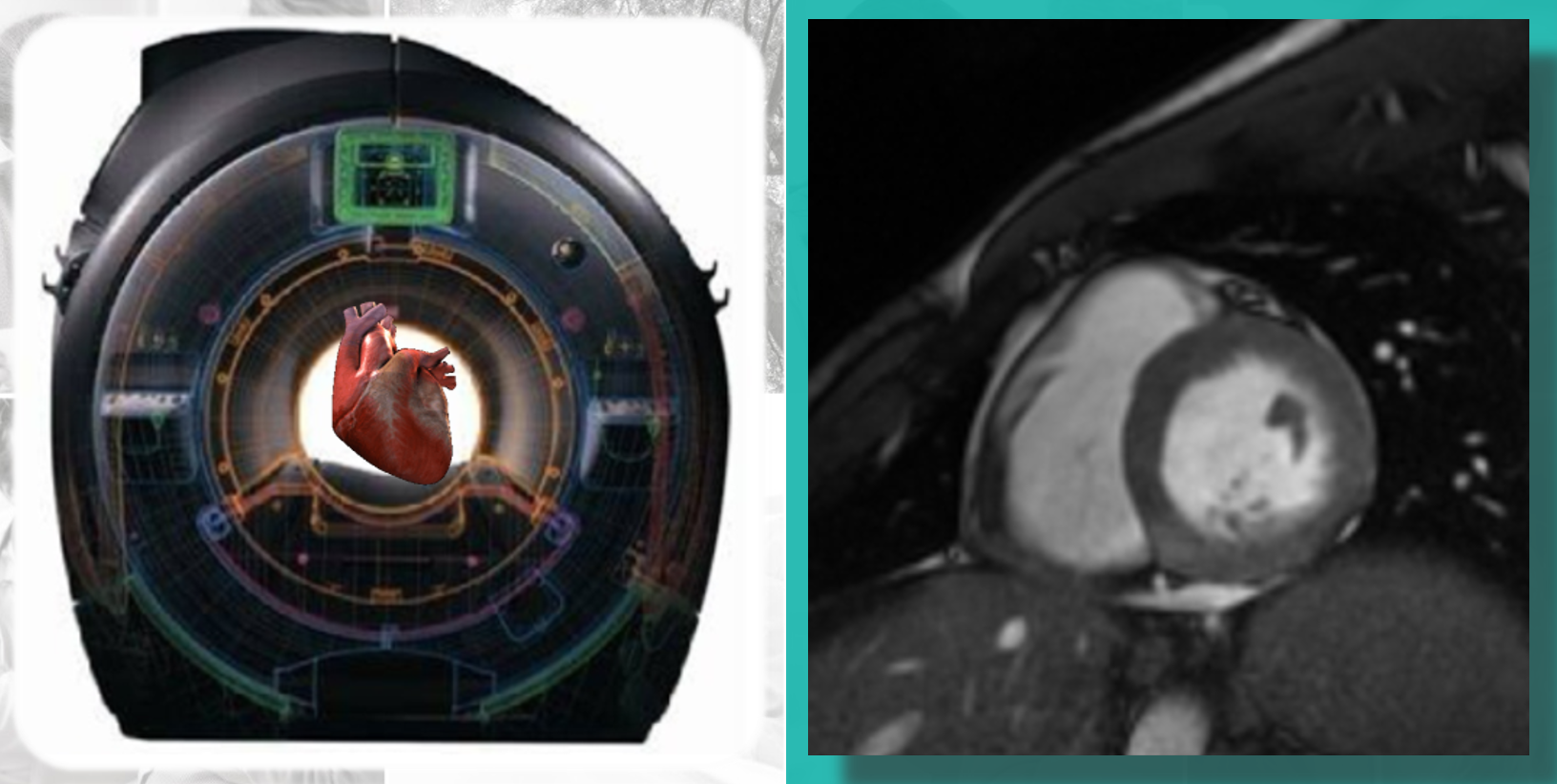 Curso Avanzado teórico-práctico de Resonancia Magnética Cardiaca para Técnicos.