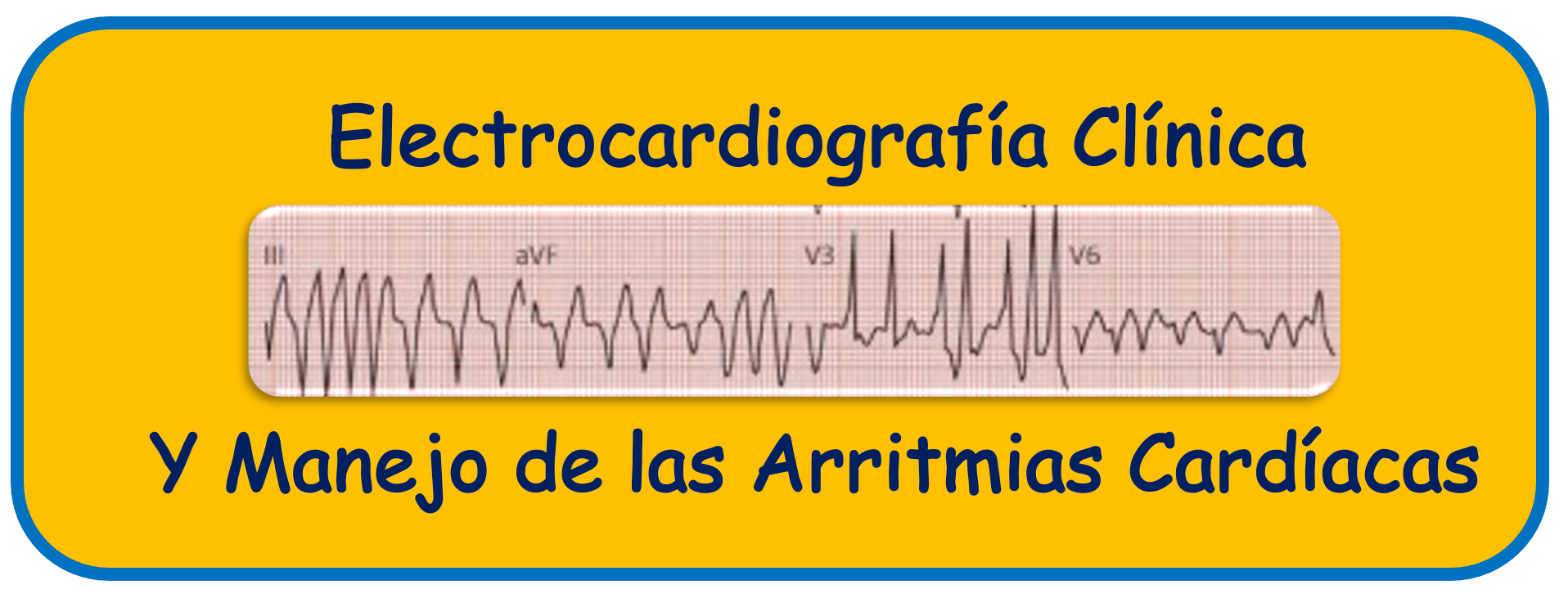 Electrocardiografía Clínica y Manejo de las Arritmias Cardiacas 
